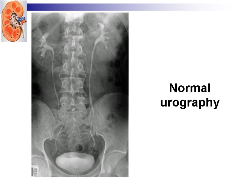 Normal urography
